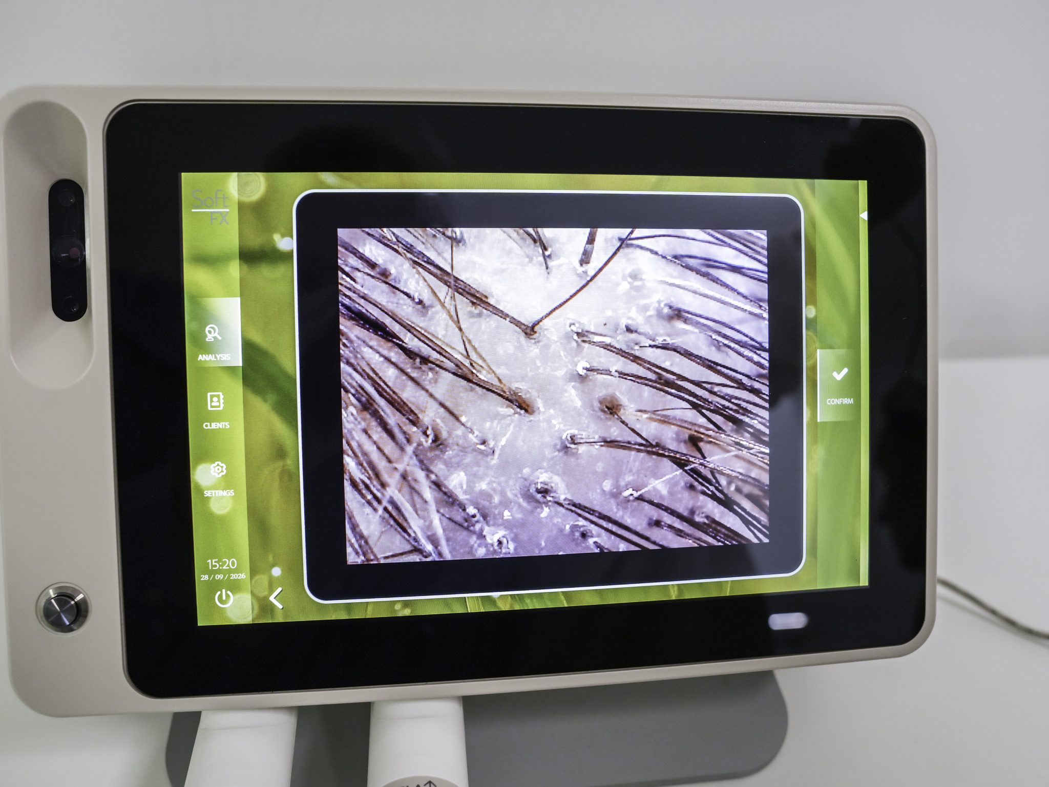 Immagine del cuoio capelluto sullo schermo della microcamera Soft FX